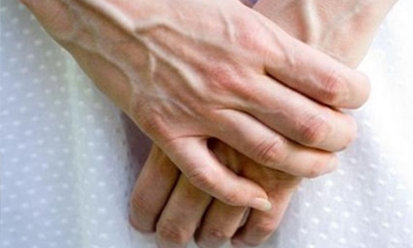 Hiện tượng nổi gân xanh cảnh báo điều gì về sức khỏe?