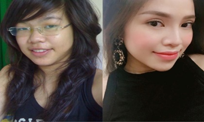 9x Sài Gòn lột xác thành hotgirl sau khi phẫu thuật thẩm mỹ