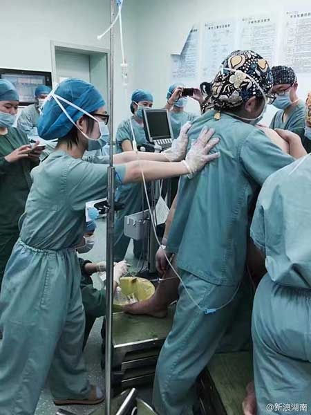 Toàn bộ 16 bác sĩ phải dồn sức, giúp đỡ nhau để đảm bảo an toàn cho mẹ và thai nhi. (Ảnh: Sina Weibo)