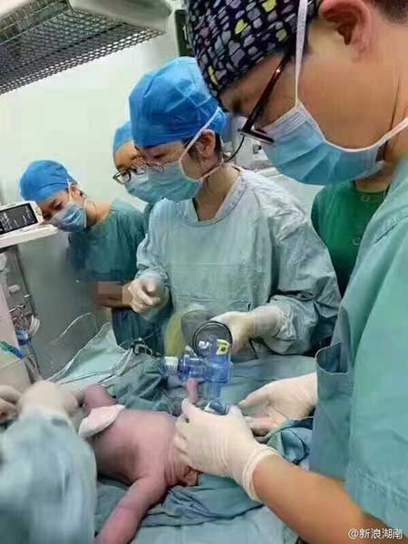   Trước nỗ lực của các nhân viên y tế, cháu bé đã trào đời khỏe mạnh.(Ảnh: Sina Weibo)  