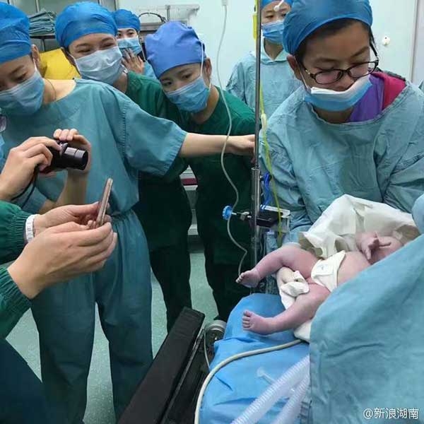   Trước khoảnh khắc chào đời của cháu bé, ngay cả các bác sĩ cũng không giấu được niềm vui. (Ảnh: Sina Weibo)  