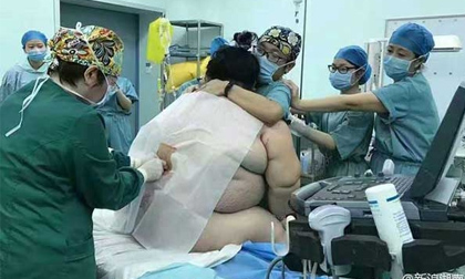Đỡ đẻ cho thai phụ nặng 140kg, gần 20 bác sĩ 'toát mồ hôi'