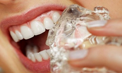 Mẹo giảm đau răng nhanh nhất tại nhà