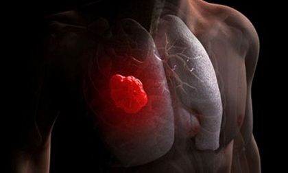 Những bệnh đàn ông thường gặp chớ chủ quan
