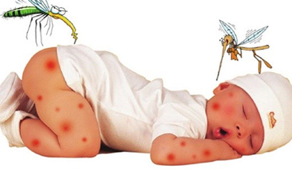 Xóa vết thâm do muỗi đốt cho trẻ vô cùng đơn giản