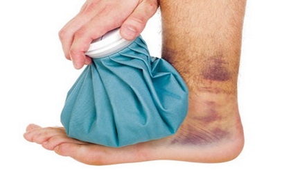 Cách xóa dấu vết bầm tím trên da