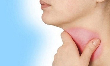 10 mẹo trị viêm họng nhanh chóng và hiệu quả nhất