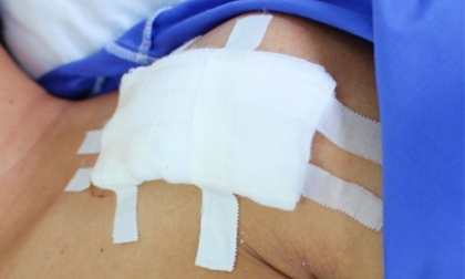 Nam sinh lớp 12 bị đâm trọng thương vì chấm 'cờ đỏ' bạn đi trễ