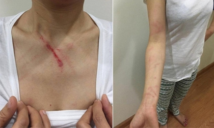 CA vào cuộc xử lý vụ người phụ nữ bị đánh trong thang máy chung cư Linh Đàm