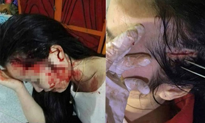 Hà Tĩnh: Vụ thiếu nữ bị hành hung dã man, xử phạt một nữ giáo viên