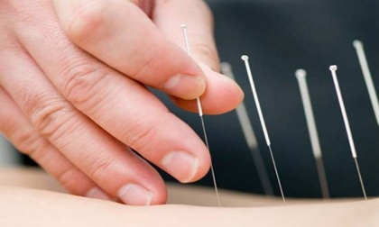 Cách chữa đau lưng nhanh nhất