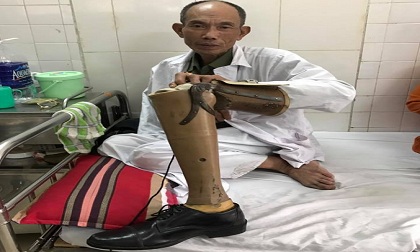 Khởi tố hình sự vụ thương binh bị hành hung giữa phố