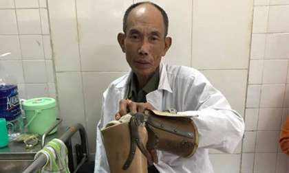 Khởi tố hai bố con đánh thương binh sau va chạm giao thông