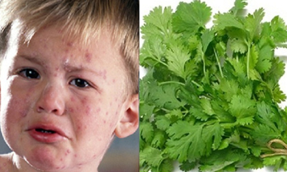 Rau mùi - thần dược chữa bệnh thủy đậu mà ai ai cũng cần giắt lưng  