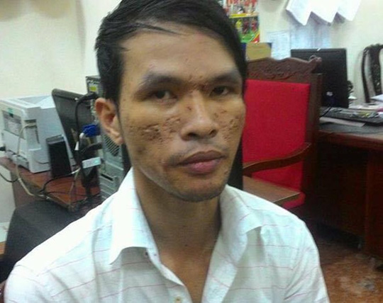 Hành trình truy bắt kẻ hành hạ dã man bé trai bằng roi điện - 1