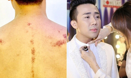 Hari won suýt 'hại' Trấn Thành vì sai lầm nguy hiểm