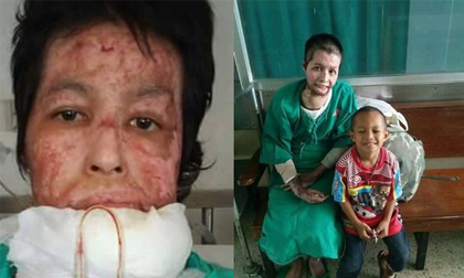 Ghen tuông, chồng tẩm xăng thiêu sống vợ khi đang nấu ăn
