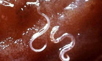 Người nuôi chó,mèo không muốn liệt chân, giun làm tổ trong não lưu ý