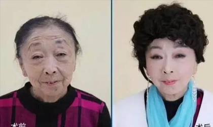 Cụ bà 71 tuổi quyết phẫu thuật thẩm mỹ để đẹp đôi với người tình 32 tuổi