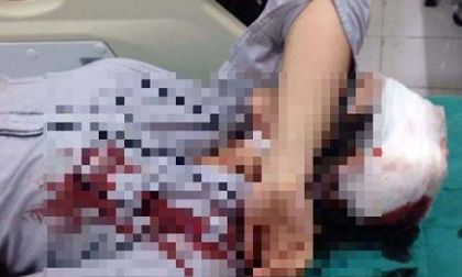 Vụ nữ sinh bị đánh gãy tay, ngất xỉu ngay tại cổng trường: Lời trần tình kinh hãi của nạn nhân