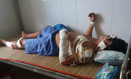 Nghi có bồ, chồng trẻ bị vợ già chém gần 20 nhát