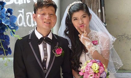 3 cặp đôi yêu nhau bất chấp ngoại hình khiến dân mạng dậy sóng