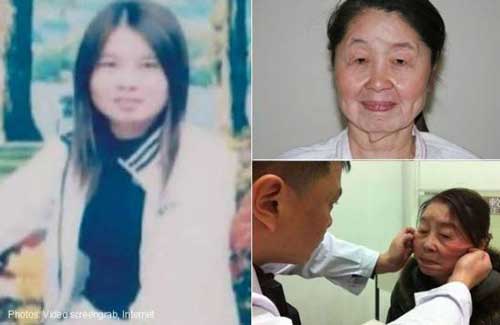 dung my pham re tien, co gai 28 tuoi dau kho vi bi bien dang thanh ba lao 80 - 2