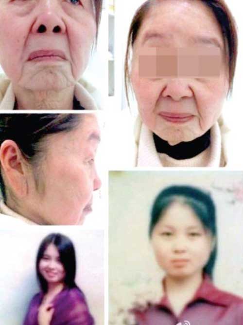 dung my pham re tien, co gai 28 tuoi dau kho vi bi bien dang thanh ba lao 80 - 4