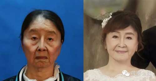 dung my pham re tien, co gai 28 tuoi dau kho vi bi bien dang thanh ba lao 80 - 8