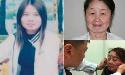 Dùng mỹ phẩm rẻ tiền, cô gái 28 tuổi đau khổ vì bị biến dạng thành bà lão 80