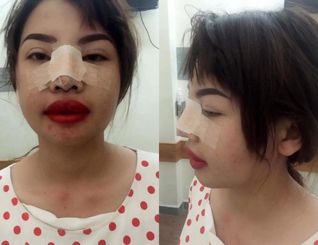 Bị bạn bè xa lánh vì ngoại hình xấu xí, bà mẹ đơn thân ở Đắk Nông quyết đập mặt làm lại - Ảnh 3. Bị bạn bè xa lánh vì ngoại hình xấu xí, bà mẹ đơn thân ở Đắk Nông quyết đập mặt làm lại - Ảnh 3.