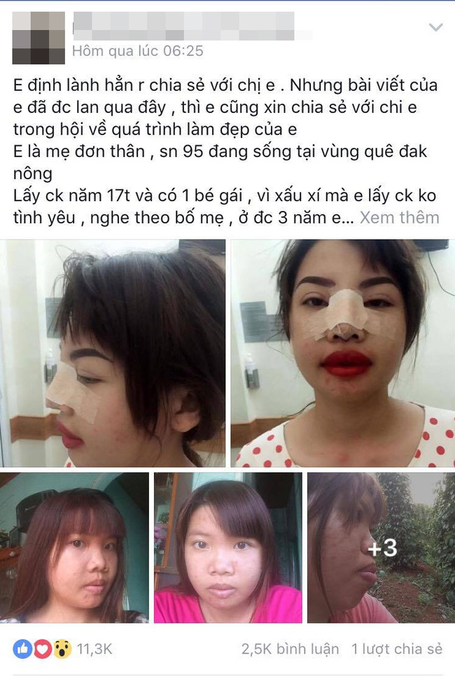 Bị bạn bè xa lánh vì ngoại hình xấu xí, bà mẹ đơn thân ở Đắk Nông quyết đập mặt làm lại - Ảnh 1. Bị bạn bè xa lánh vì ngoại hình xấu xí, bà mẹ đơn thân ở Đắk Nông quyết đập mặt làm lại - Ảnh 1.
