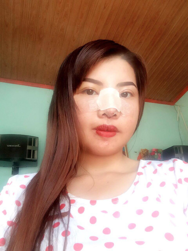 Bị bạn bè xa lánh vì ngoại hình xấu xí, bà mẹ đơn thân ở Đắk Nông quyết đập mặt làm lại - Ảnh 4. Bị bạn bè xa lánh vì ngoại hình xấu xí, bà mẹ đơn thân ở Đắk Nông quyết đập mặt làm lại - Ảnh 4.