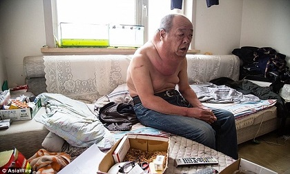 Người đàn ông mang khối u khổng lồ trên cổ