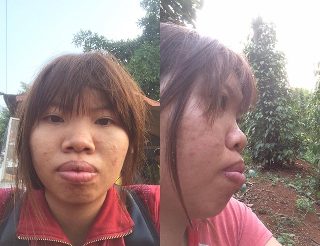 Bị bạn bè xa lánh vì ngoại hình xấu xí, bà mẹ đơn thân ở Đắk Nông quyết đập mặt làm lại - Ảnh 2. Bị bạn bè xa lánh vì ngoại hình xấu xí, bà mẹ đơn thân ở Đắk Nông quyết đập mặt làm lại - Ảnh 2.