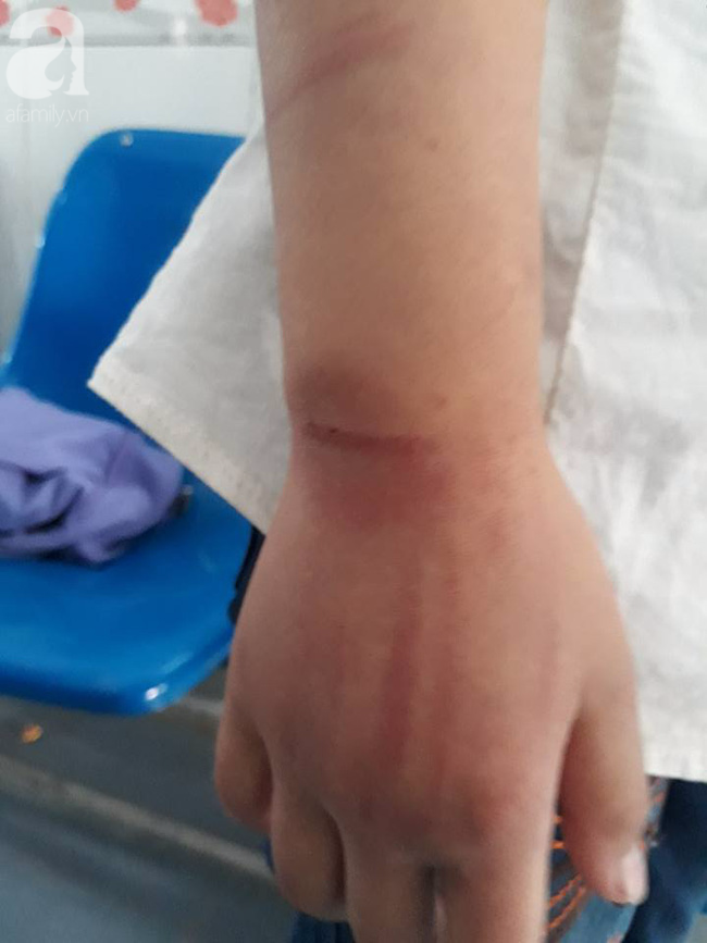 Vụ bé gái 10 tuổi bị bố đánh bầm tím toàn thân: Người mẹ nhiều lần bị chồng đánh đập - Ảnh 4. Vụ bé gái 10 tuổi bị bố đánh bầm tím toàn thân: Người mẹ nhiều lần bị chồng đánh đập - Ảnh 4.