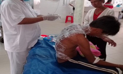 Dùng xăng đốt chuột, nam sinh cháy như ngọn đuốc