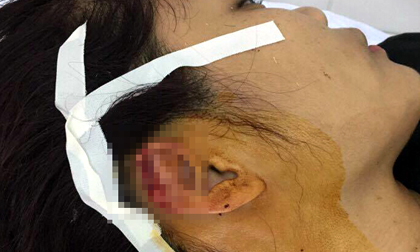 Hải Dương: Phụ huynh lao vào lớp học hành hung, cắn đứt tai giáo viên dạy khiêu vũ