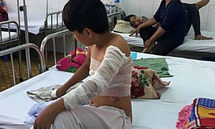 Chồng đi nhậu về gây sự, tưới xăng phóng hỏa khiến vợ và con trai bỏng nặng  