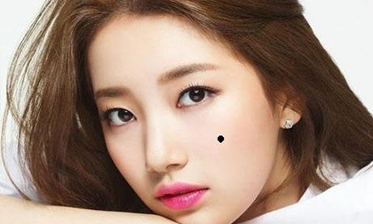 3 vị trí nốt ruồi trên má nói lên điều gì?