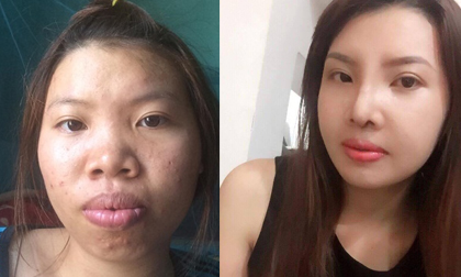 Diện mạo mới của bà mẹ đơn thân bị xa lánh vì xấu sau quá trình 'đập đi xây lại nhan sắc'