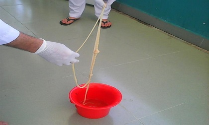 Kinh hoàng bà lão sống chung với sán sơ mít dài 5m trong cơ thể nhiều năm trời