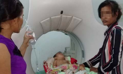 Bé 11 tháng tuổi nguy kịch vì thói quen quấn khăn của bố mẹ khi đi xe máy