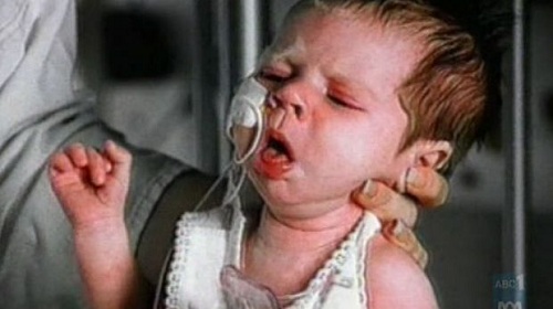 10 căn bệnh tưởng đã biến mất nhưng vẫn đe dọa loài người - 4