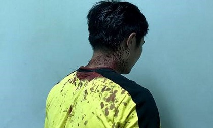 Giang hồ đập tan hoang 5 phòng trọ, trung úy CSGT bị đánh chảy máu đầu