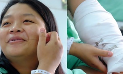 Cô gái bị máy cắt giấy chém lìa cánh tay: Bạn trai sắp cưới túc trực bên giường bệnh, xin cơm từ thiện cho ăn