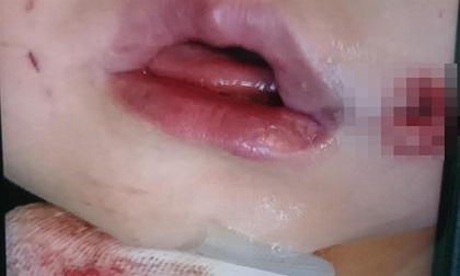 5 loại thực phẩm độc hại ngoài chợ tuyệt đối không nên mua