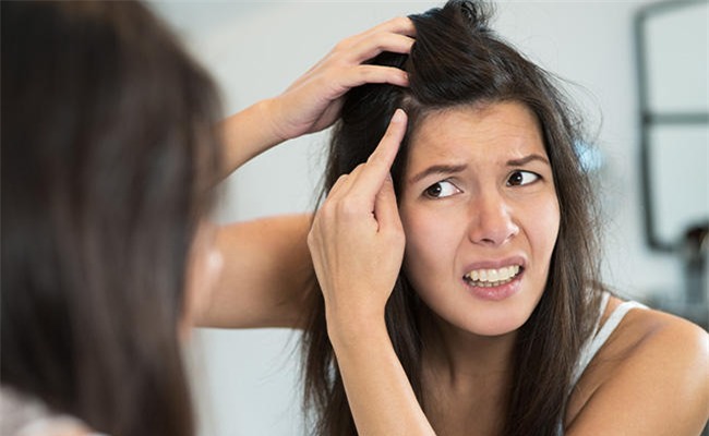 Cảnh báo hội chứng trichotillomania từ thói quen tự nhổ tóc quá nhiều mỗi ngày