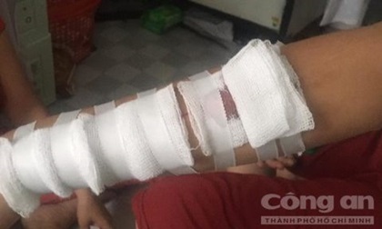 Nữ sinh lớp 10 bị bạn dùng lưỡi lam rạch tay