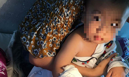 Bé trai tay bị thang máy cuốn ở sân bay Tân Sơn Nhất sẽ phải tháo ngón tay út